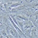 NCI-H2452 人间皮瘤细胞