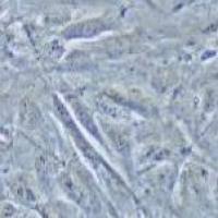 NCI-H2452 人间皮瘤细胞