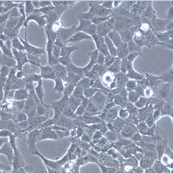 HCT-8[HRT-18]细胞系、HCT-8[HRT-18]细胞、HCT-8[HRT-18]回盲肠癌细胞，
