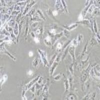 U2OS 人骨肉瘤细胞