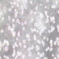 T2 人淋巴母细胞