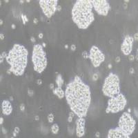 Jurkat（clone E6-1）人T淋巴细胞白血病细胞