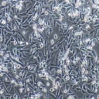 A375 人恶性黑色素瘤细胞