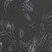 SW982 人滑膜肉瘤细胞