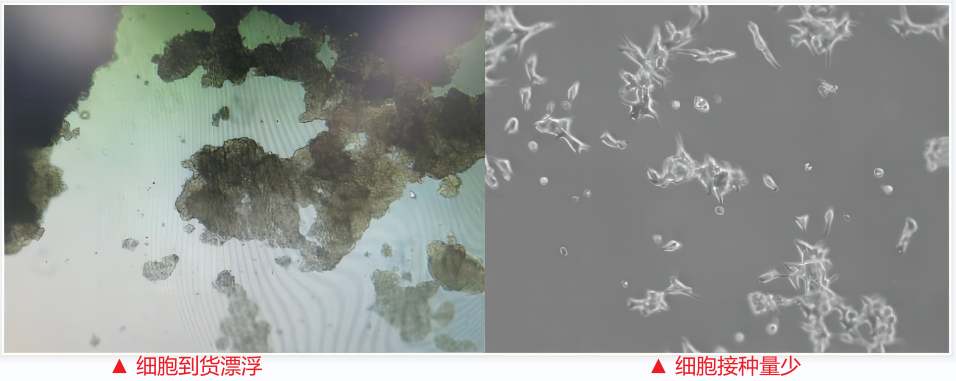 LNCaP Clone FGC细胞(人前列腺癌细胞)培养攻略
