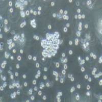 Raji 人淋巴瘤细胞