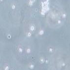 Hut-78 人T淋巴细胞白血病细胞