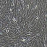 HSF(SV40转染) 人真皮成纤维细胞永生化