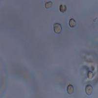 MOLT-4 人急性淋巴母细胞性白血病细胞