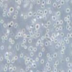 Karpas-299 人间变性大细胞淋巴瘤细胞