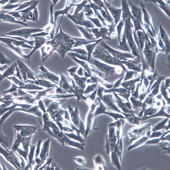 HCC94 细胞系、HCC94 细胞、HCC94 子宫鳞癌细胞（高分化）