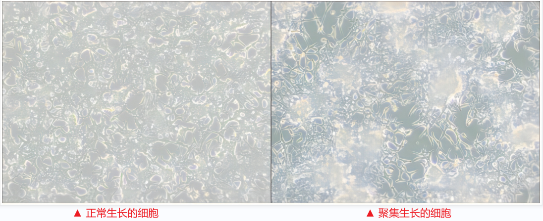 LNCaP Clone FGC细胞(人前列腺癌细胞)培养攻略