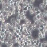 SUP-B15 人Ph+急林白血病细胞