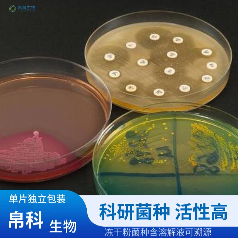 PAO1铜绿假单胞菌（绿色荧光）
