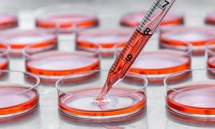 LNCaP Clone FGC细胞(人前列腺癌细胞)培养攻略