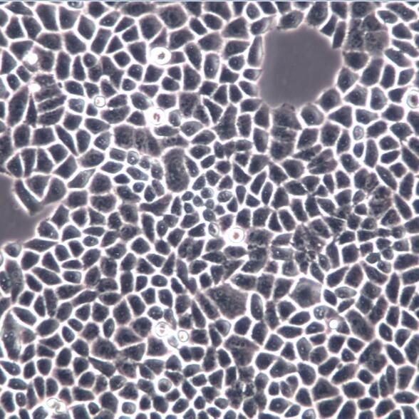 JAR细胞系、JAR细胞、JAR胎盘绒毛癌细胞 