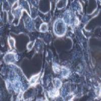 RD 人横纹肌肉瘤细胞