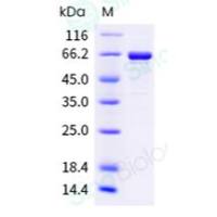 重组人 Hsp90 alpha 蛋白 (全长) (His 标签)