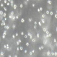 NALM-6 人B淋巴白血病细胞