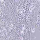 BeWo 人胎盘绒膜癌细胞