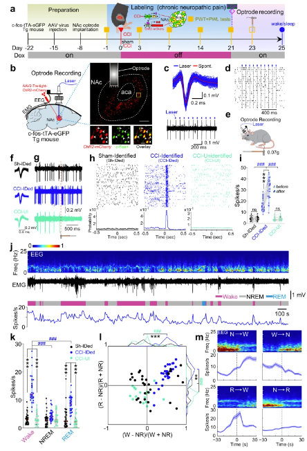 病毒示踪神经环路结合光遗传研究发现——疼痛和睡眠障碍具有相同的伏隔核神经调控机制