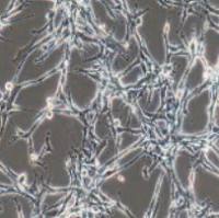 U118MG 人脑星形胶质母细胞瘤