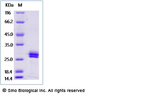 文献速递  张金方团队揭示免疫检查点PD-1调控新机制和肿瘤联合治疗新策略