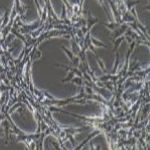 U87MG 人脑星形胶质母细胞瘤