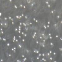 HEL 人红白细胞白血病细胞