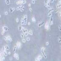 D341 Med 人脑髓母细胞瘤细胞