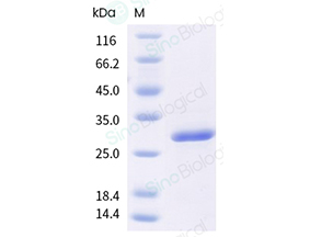 重组人 PPARA 蛋白 (His 标签)