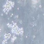SU-DHL-2 人B细胞淋巴瘤细胞