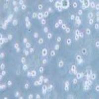 DB 人弥漫性大B细胞淋巴瘤细胞