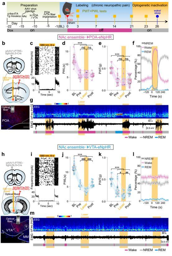 病毒示踪神经环路结合光遗传研究发现——疼痛和睡眠障碍具有相同的伏隔核神经调控机制