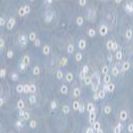 MV-4-11 人髓性单核细胞白血病细胞