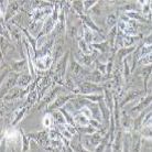 SNB-19 人胶质瘤细胞