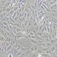 T98G 人胶质母细胞瘤