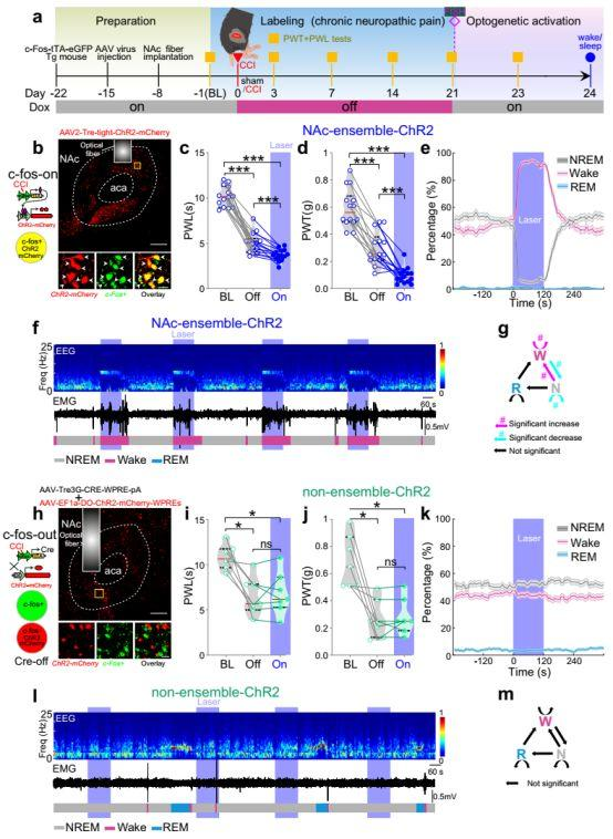病毒示踪神经环路结合光遗传研究发现——疼痛和睡眠障碍具有相同的伏隔核神经调控机制