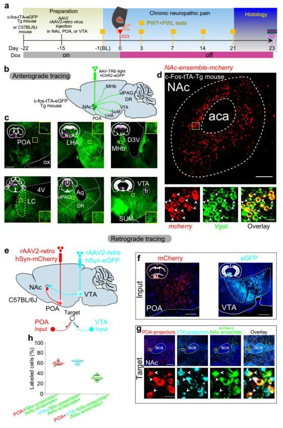 病毒示踪神经环路结合光遗传研究发现——疼痛和睡眠障碍具有相同的伏隔核神经调控机制