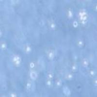 Kasumi-1 人红白血病细胞