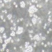 J.gamma1 人急性T细胞白血病细胞