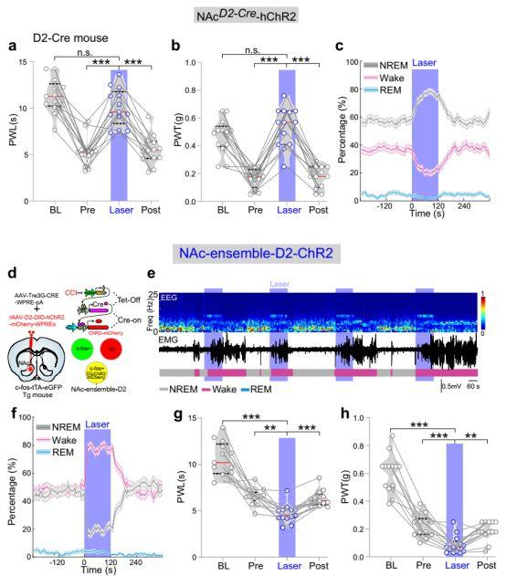 病毒示踪神经环路结合光遗传研究发现——疼痛和睡眠障碍具有相同的伏隔核神经调控机制
