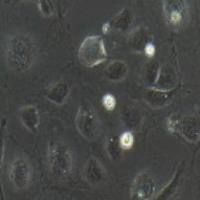 HUVEC 人脐静脉内皮细胞永生化