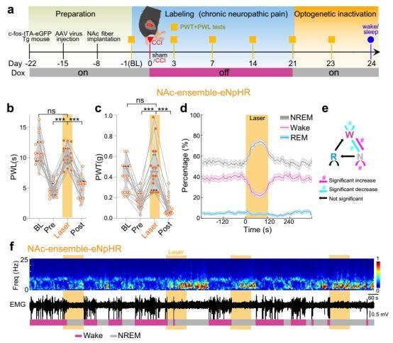 病毒示踪神经环路结合光遗传研究发现——疼痛和睡眠障碍具有相同的伏隔核神经调控机制