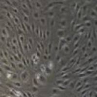 HUVEC+RFP 人脐静脉内皮细胞永生化+RFP