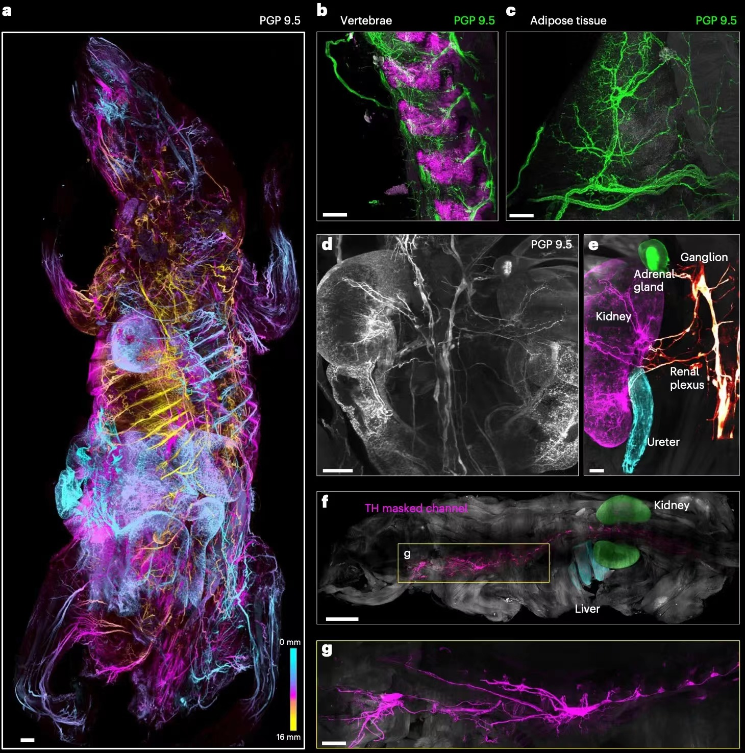 Nature Biotechnology（IF=46.9）：组织透明化技术新突破——小鼠全身免疫荧光标记结合组织透明化技术获得完整小鼠三维整体结构