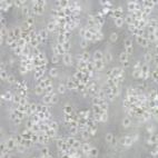 OKT11 小鼠杂交瘤（抗CD2）细胞