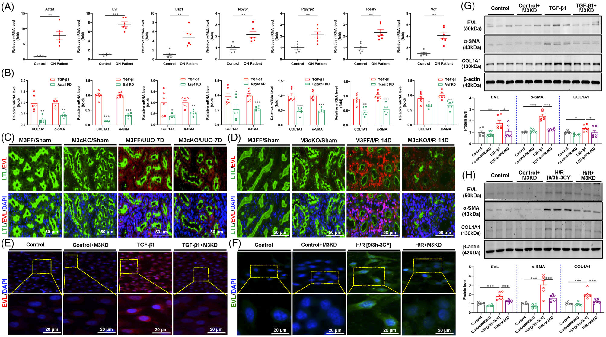 基因和药物抑制METTL3减少肾纤维化的表观遗传多组学机制研究