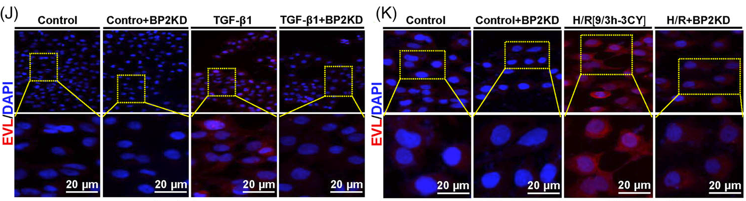 基因和药物抑制METTL3减少肾纤维化的表观遗传多组学机制研究