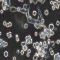 LLC 小鼠Lewis肺癌细胞